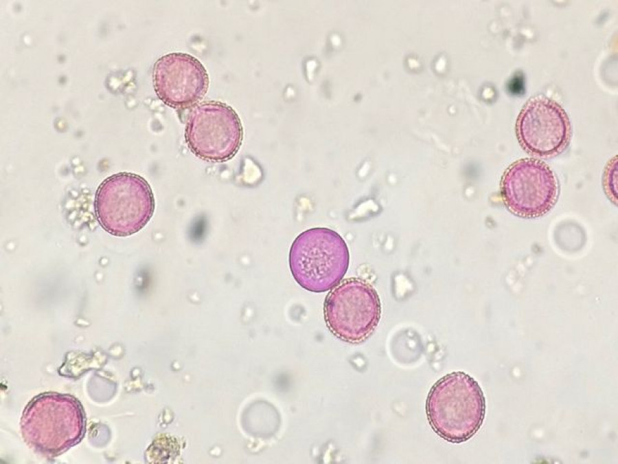 Imagen microscopio granos polen olivo graminea oleo