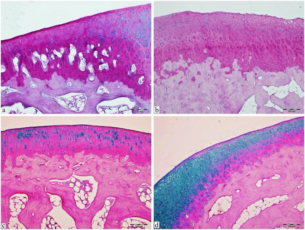 Aove osteoporosis oleo270624